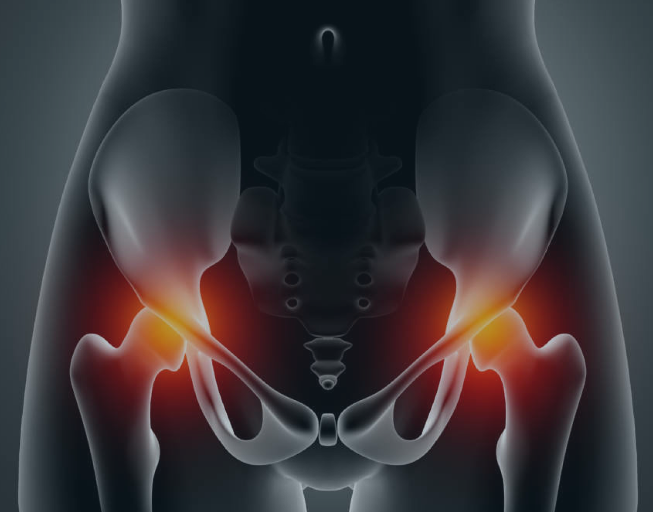 Especialista em Quadril em São Paulo