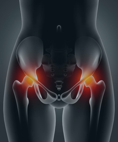 Especialista em Quadril em São Paulo